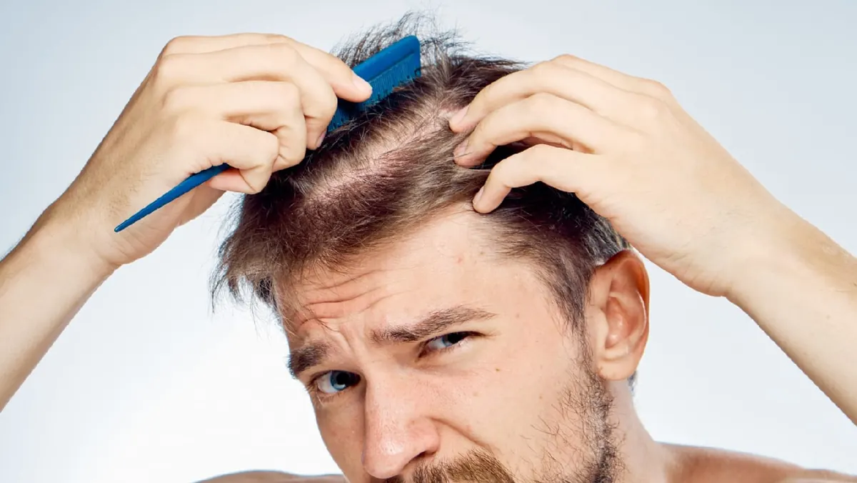 Hair loss treatment in Indore